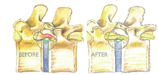 Chiropractic Greer SC Acupressure Graphic