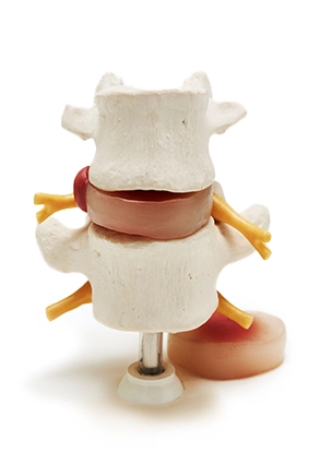 Chiropractic Greer SC Vertebrae Model Chiropractic Greer SC Vertebrae Model